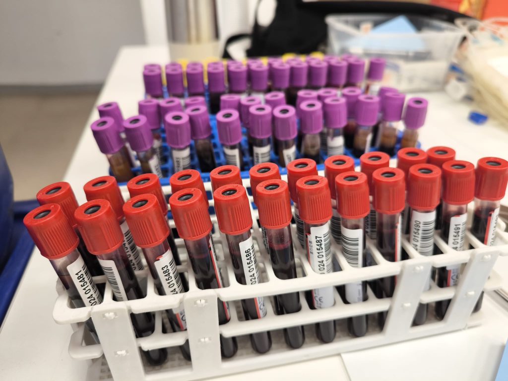 Prikupljanje krvi u Samoboru 4. i 6. kolovoza