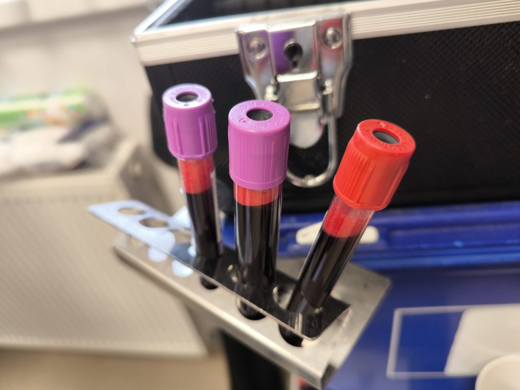 Tri dana darivanja krvi u rujnu